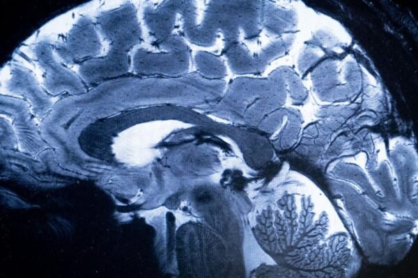 Cobenfy is the first antipsychotic drug to treat schizophrenia by targeting cholinergic receptors instead of dopamine receptors