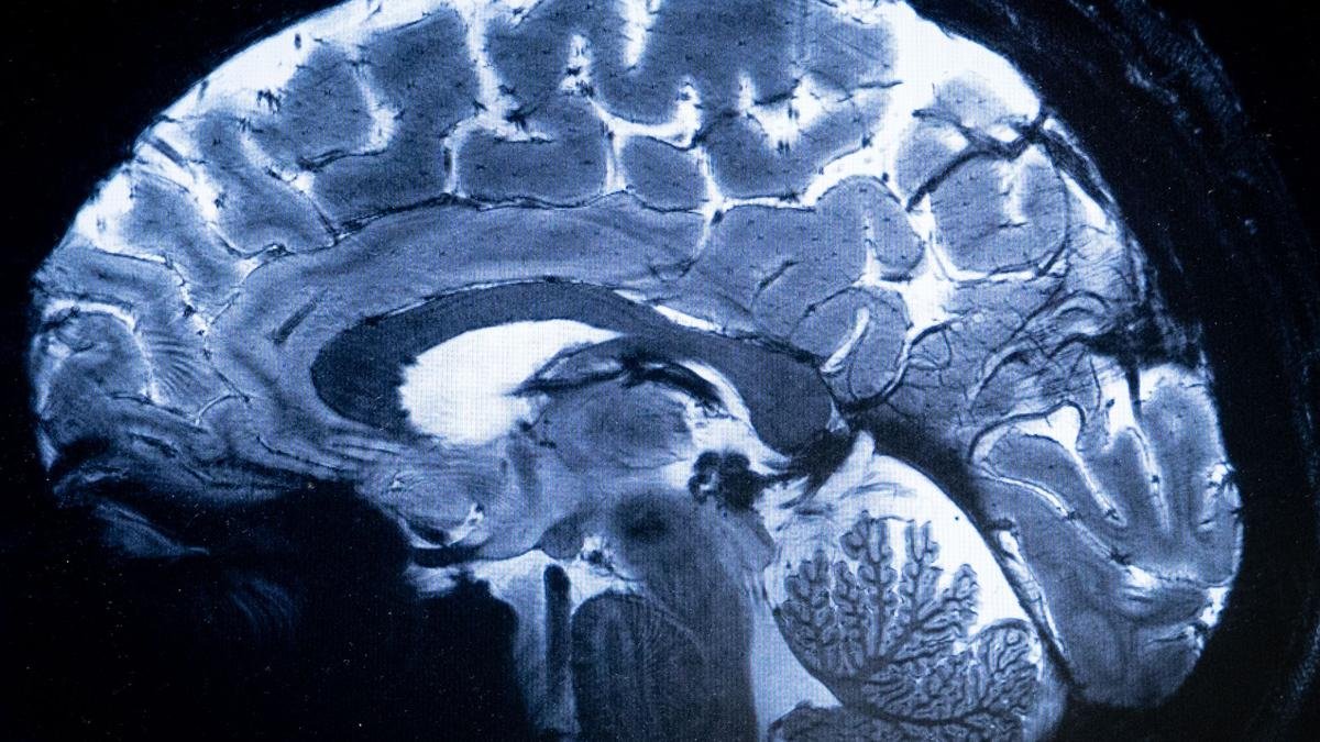 Cobenfy is the first antipsychotic drug to treat schizophrenia by targeting cholinergic receptors instead of dopamine receptors